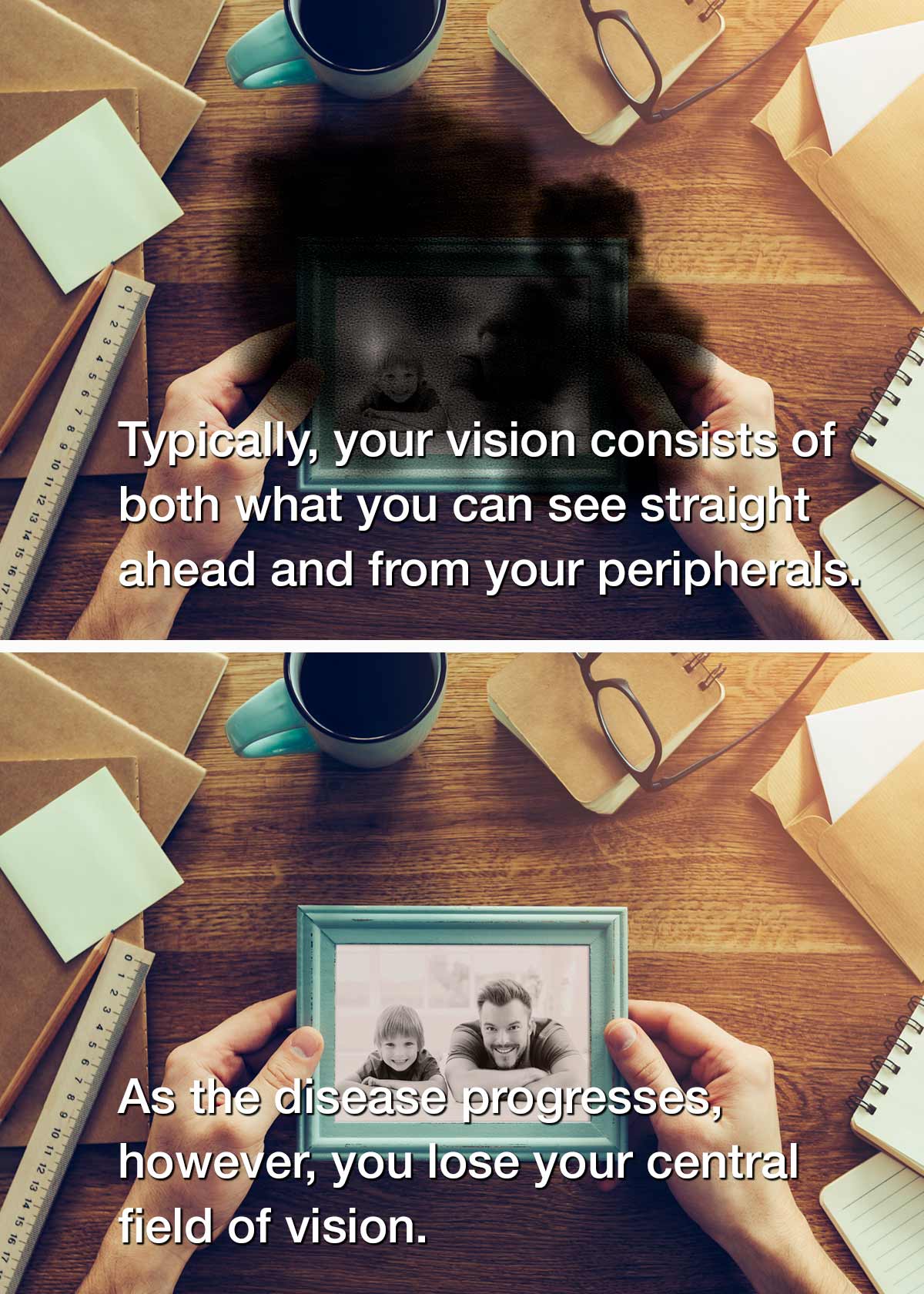 two photos comparing sight with and without AMD
