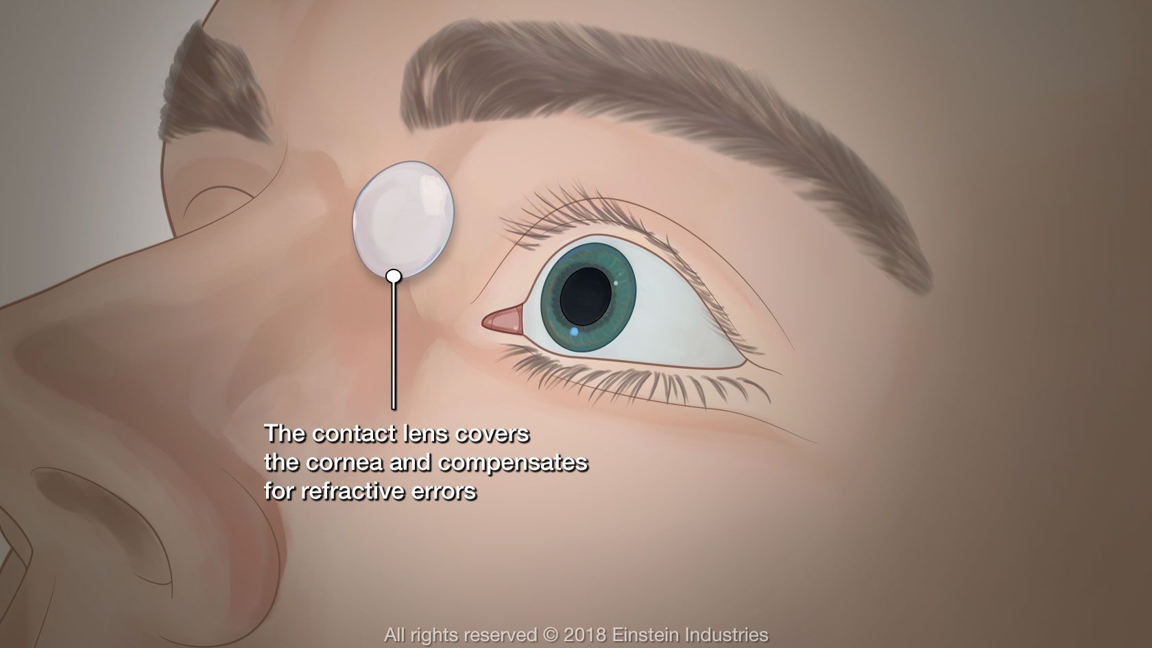 Illustration of how contacts work