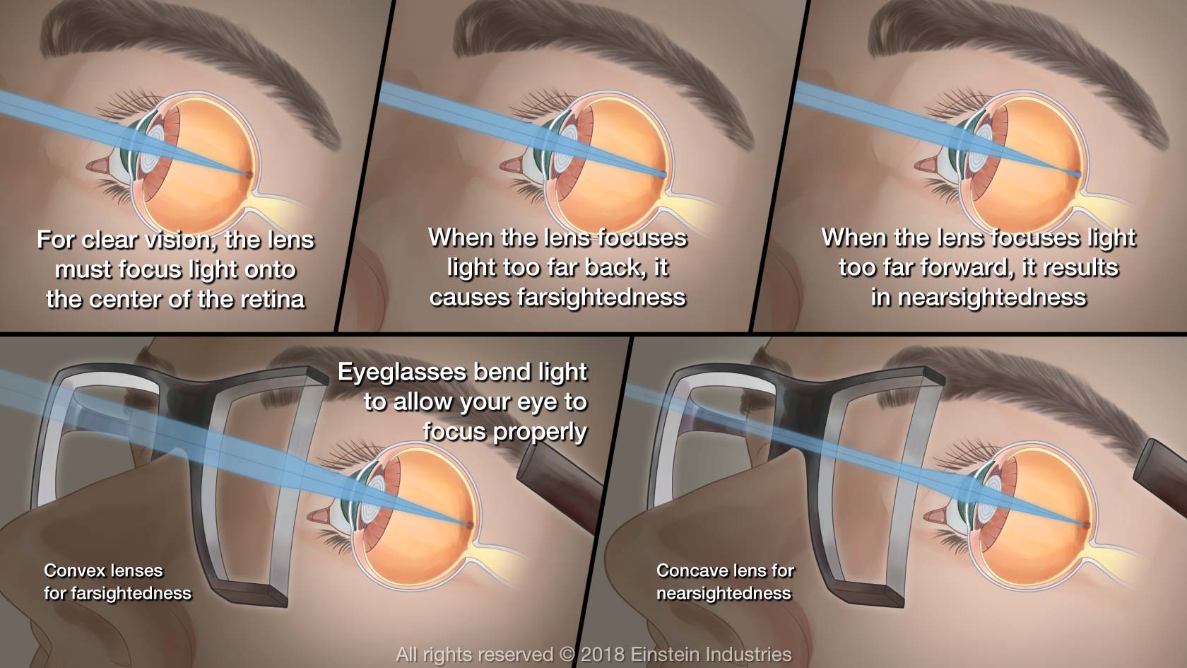 Illustration showing how glasses work